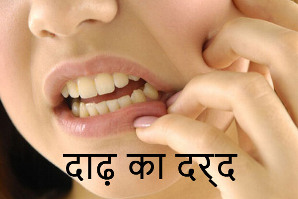 दाढ़ का दर्द